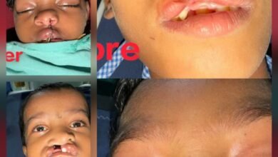 चिरायु योजना से उपचार के बाद बच्चे और परिवार